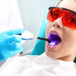 Teknologi Laser Baru Tambal Gigi Tanpa Rasa Sakit Dan Bor