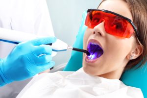 Teknologi Laser Baru Tambal Gigi Tanpa Rasa Sakit Dan Bor